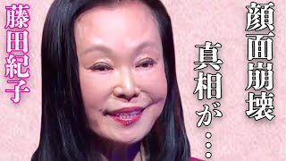 藤田紀子が「私はもう死ぬ」とまで言った病魔の正体…顔面崩壊した現在の姿に言葉を失う…「女の市場」でも有名な女優の息子・貴乃花と若乃花の確執の理由に驚きを隠せない…