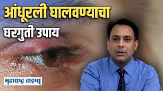 Stye Causes | आंधूरली घालवण्यासाठी डॉक्टरांकडून ऐका सोपा उपाय | Andhurli | Maharashtra Times