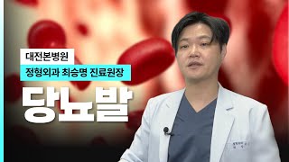 당뇨발 I 대전본병원 정형외과 최승명 진료원장