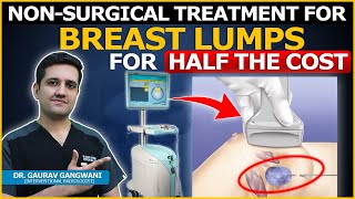 Breast Fibroadenoma/Lump Treatment at Very Low Cost | Dr. Gaurav Gangwani (IR)