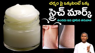 చర్మం పై ఒక్కటంటే ఒక్క Stretch Marks ఉండదు ఇది పూసిన తరువాత | Dr Manthena Satyanarayana Raju Videos