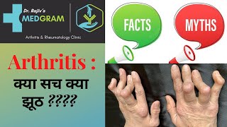 ARTHRITIS : क्या सच क्या झूठ ??? (HINDI)? by Dr. Rajiv Ranjan (DM Rheumatologist, PGI, Chandigarh)