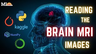 5-Reading the Brain MRI images in Python