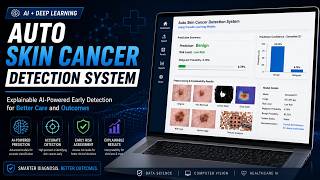 Auto Skin Cancer Detection System Using AI & Deep Learning | Explainable AI Project