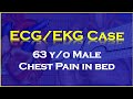 ECG/EKG Case: 63 y/o Male experiencing chest pain in bed.