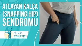 Atlayan Kalça Sendromu Nedir? Snapping Hip Neden Olur?