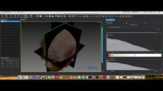 MPHY0026: Volume Rendering Example