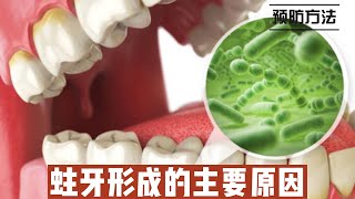 蛀牙形成的主要原因及预防方法@168Health