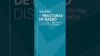 Solución a fracturas de radio distal con mal-unión