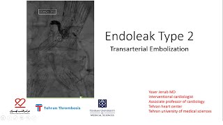 Endoleak Type 2:  Transarterial Embolization