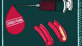 Understanding Blood Test Video 1: Lipid Profile and Hemoglobin A1C