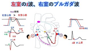 心電図：暗記からの卒業 103話 J波症候群