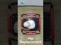 how to improve balance and stability after surgery total hip replacement senior rehab