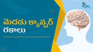 మెదడు క్యాన్సర్ రకాలు | Types of brain cancers that spread to the  brain | Dr soma Madhan Reddy