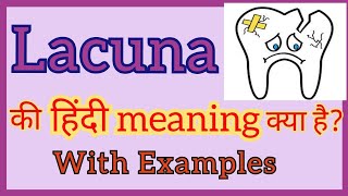 What is the meaning of Lacuna | What is Lacuna