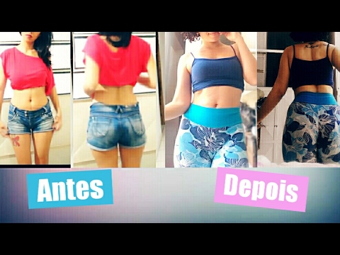 BUCLINA-RESULTADO ANTES E DEPOIS - YouTube