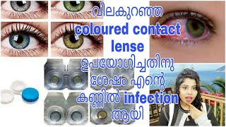 വിലകുറഞ്ഞ coloured contact lense  ഉപയോഗിച്ചതിനു  ശേഷം എന്റെ കണ്ണിൽ infection ആയി