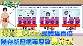 腸胃道ACE2受體達百倍 殘存新冠病毒可導致長新冠 健康2.0