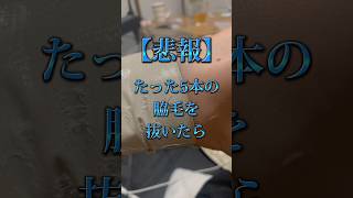 こんな仕打ちある？脇毛に罪はないのに‼️😭