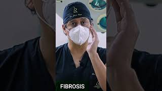 FIBROSIS Y CALLO ÓSEO