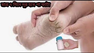 মাত্র ৭দিনে পা ফাটা দুর করার ঘরোয়া টিপস।একবার হলেও এটা লাগান অনেক ভালো উপকার আসবে।