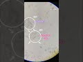 urine in microscope 🔬🔬 youtube