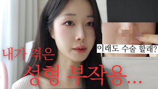 흉터가 진짜 이래요.. 인중축소 성형 부작용 겪은썰 풀면서 외출준비 GRWM