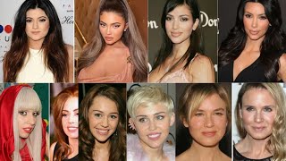 10 Celebrity Transformations That Went Too Far – You Won’t Believe