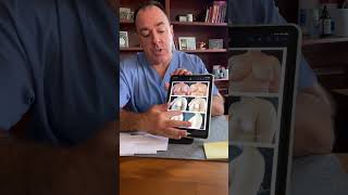How much does a breast reduction surgery cost? Board Certified Plastic Surgeon Sean Doherty explains