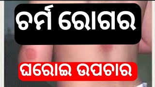 ଚର୍ମ ରୋଗର ଘରୋଇ ଉପଚାର ! Skin Disease Treatment !