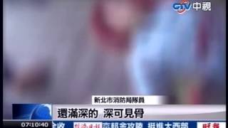 中視新聞》疑打籃球起爭執 16歲少年遭砍斷臂