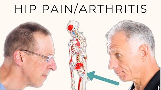 Hip Pain/Arthritis? 8 Strongly Recommended Treatments By Experts