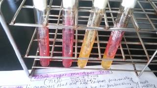 Triple sugar Iron (TSI) Test/Kligler iron agar (KIA) test for bacteria