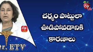 చర్మం పొట్టులా ఊడిపోవడానికి కారణాలు డాక్టర్ ఈటీవీ  | 29th జనవరి 2022| ఈటీవీ  లైఫ్