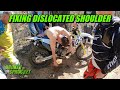 Fixing Dislocated Shoulder after Dirt Bike Crash te300