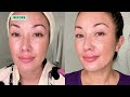 Cosmelan Chemical Peel at Home for Dark Spots My Experience & Results