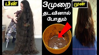 3முறை-தடவினால்-முடி-அடர்த்தியா-வளரும் | Hair growth tips in tamil | mudi valara tips