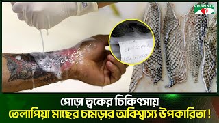 পোড়া ত্বকের চিকিৎসায় তেলাপিয়া মাছের চামড়ার অবিশ্বাস্য উপকারিতা!