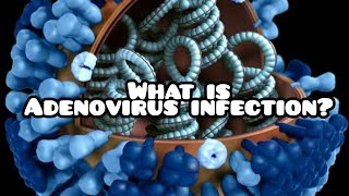 What is adenovirus infection | Summary