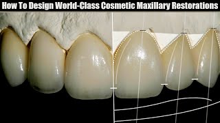 How to Design World-Class Cosmetic Maxillary Restorations