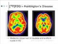 Advances in Alzheimer's Disease: Imaging and Biomarker Research