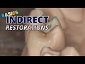 Basics of Indirect Restorations Part 1 - Decision Making - PS006