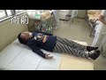 頭が上がらない、足を引きずる（多巣性ジストニア ）▶動画