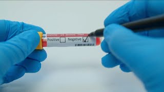 False Negatives A Concern With Covid Tests