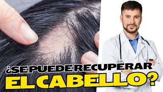 La Verdad Sobre La Pérdida de Cabello Que NADIE Te Dice!