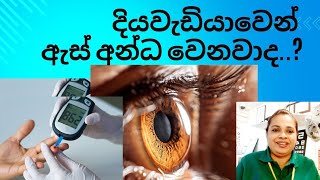 Diabetic and your Vision දියවැඩියා වෙන් ඇස් අන්ධ වෙනවාද..?