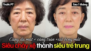 Bỗng dưng trẻ ra đến nỗi ai cũng tưởng lão hóa ngược????😵😵