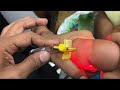 Baby Cannulation & Blood Sampling/ blood collection for baby