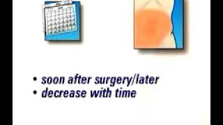 PreOp® Patient Education Gallbladder Removal Laparoscopic Ha