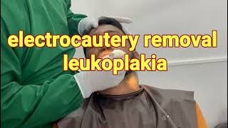 LEUKOPLAKIA SURGERY